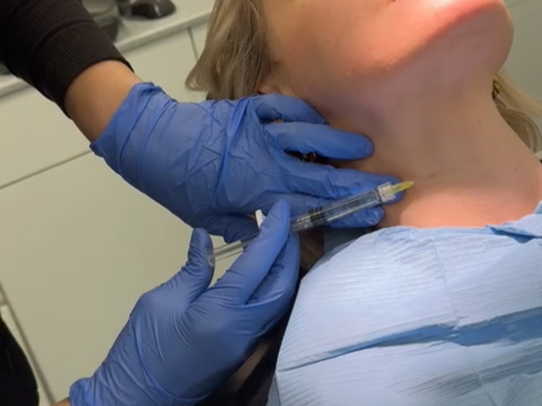 Polynucleotide skin treatment with Plenhyage